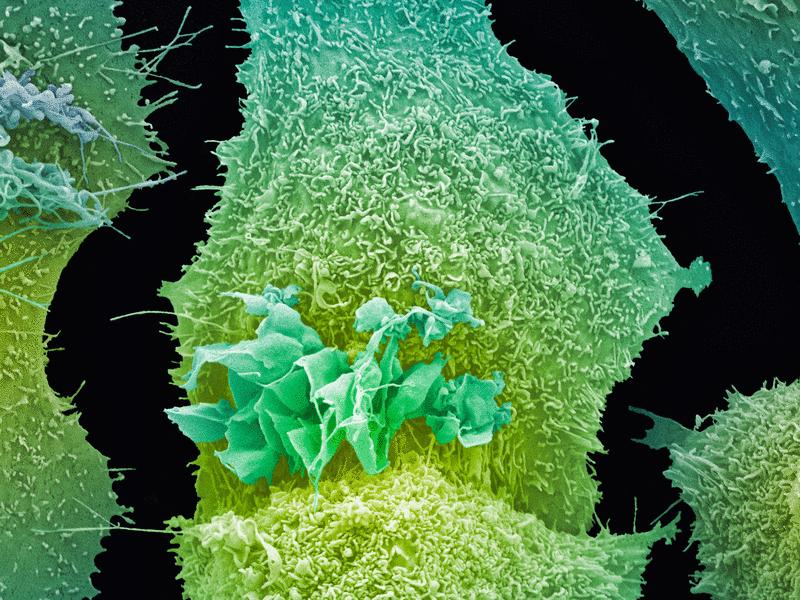 SOS1 inhibition suppresses the emergence of osimertinib resistance to generate a durable response in EGFR-mutant lung cancer | Science Signaling