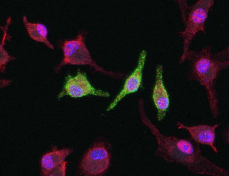 The mechanosensitive channel TRPV4 inhibits pulmonary inflammation by limiting NF-κB signaling in alveolar macrophages | Science Signaling