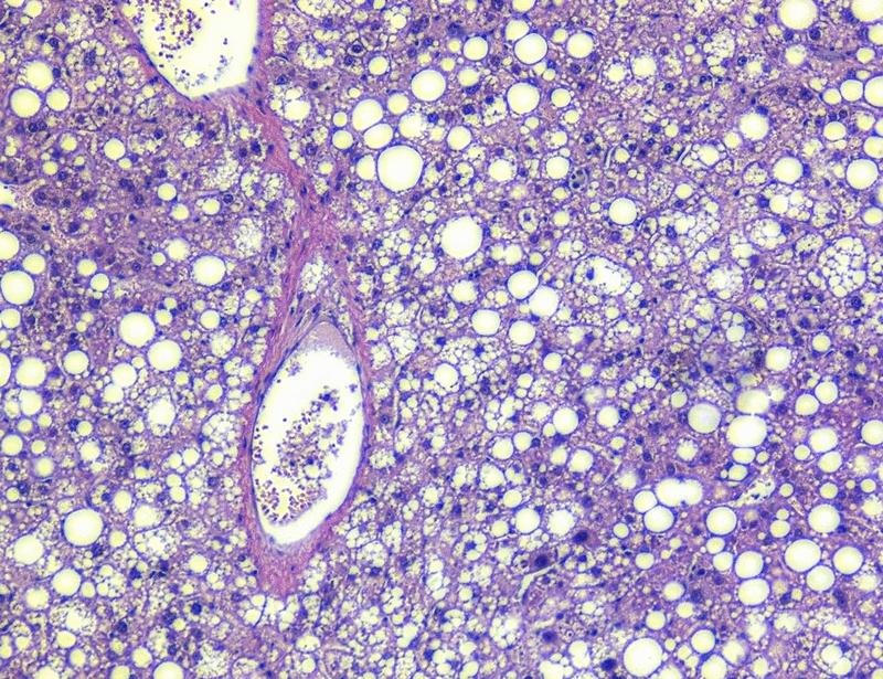 The protein denitrosylase SCoR2 regulates lipogenesis and fat storage | Science Signaling