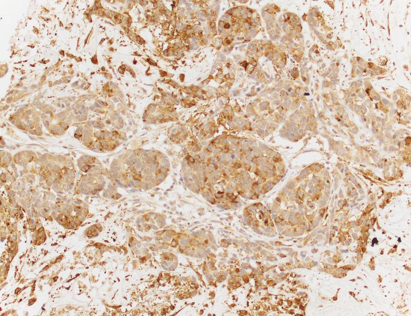 Stabilization of IQGAP1 by the mTORC2 component PRR5 mediates mitogenic LINC01133-to-ERK signaling in triple-negative breast cancer | Science Signaling