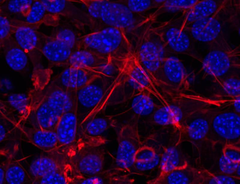 Pervanadate-induced oxidation relieves autoinhibition of the protein tyrosine kinase SRC | Science Signaling