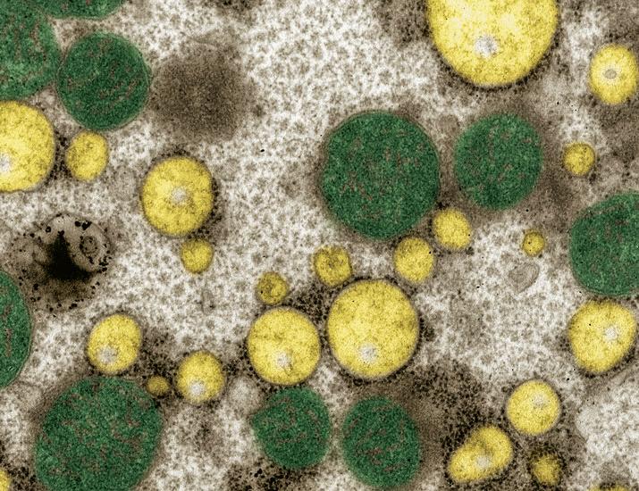 The ubiquitin E3 ligase HRD1 restricts hepatic lipid metabolism by suppressing PPARα-driven m6A RNA modification | Science Signaling