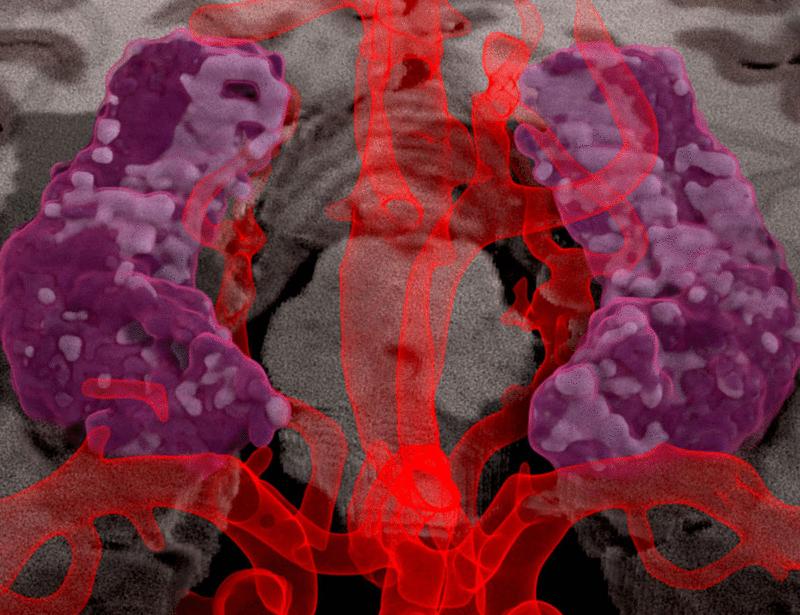 Acetate enhances long-term memory in female mice by sex-, context-, and brain region–specific epigenetic and transcriptional remodeling | Science Signaling