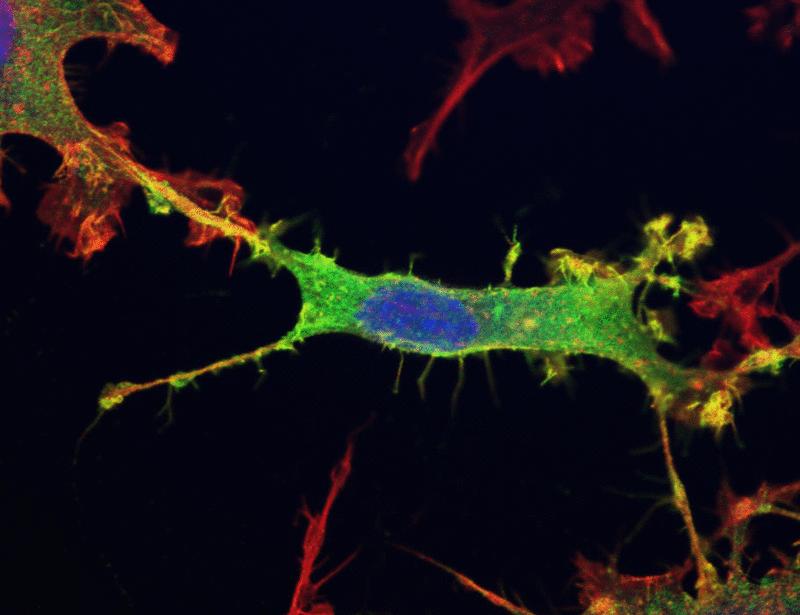 The unphosphorylated, closed form of ezrin binds to RNA to maintain a metastatic phenotype in osteosarcoma cells | Science Signaling