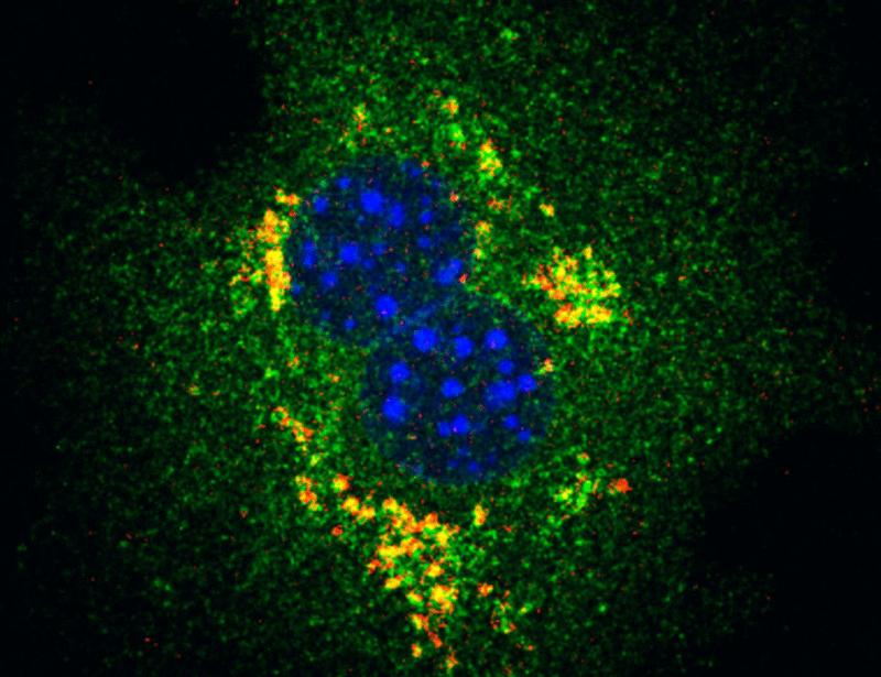 Glycerol 3-phosphate activates lipid metabolism through GATOR2-dependent regulation of mTORC1 | Science Signaling