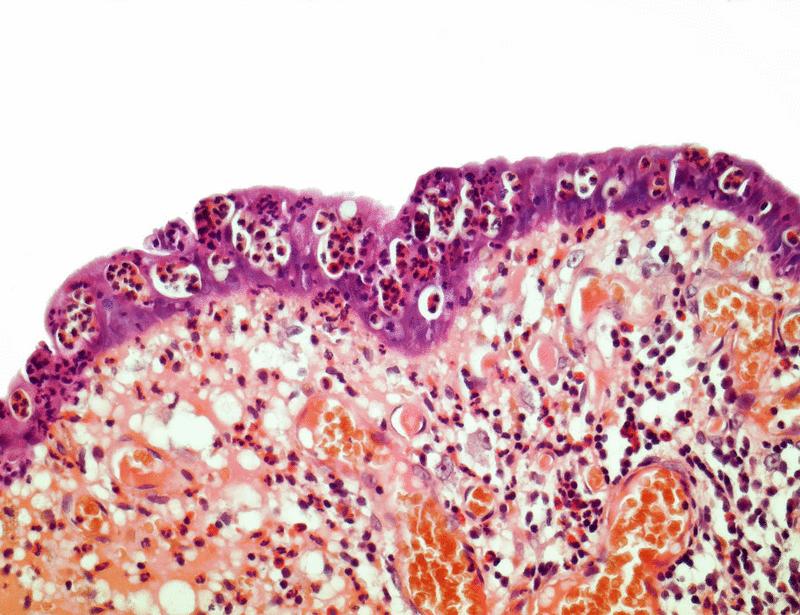 Decoding cytokine networks in ulcerative colitis to identify pathogenic mechanisms and therapeutic targets | Science Signaling