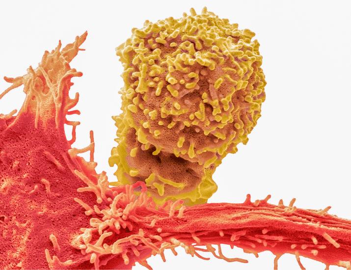 Interleukins 15 and 18 synergistically prime the antitumor function of natural killer cells through noncanonical activation of mTORC1 | Science Signaling