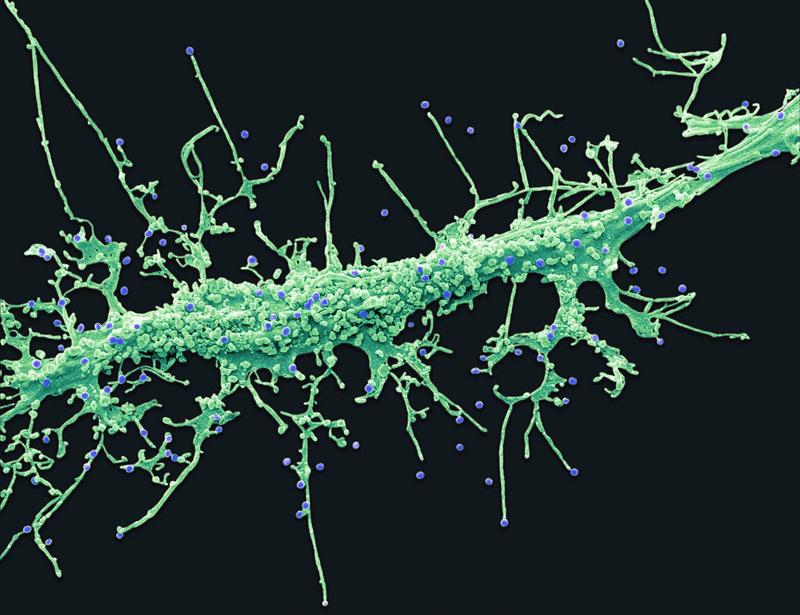 Identification of proteins in semen-derived extracellular vesicles that bind to Tat and NF-κB and that may impair HIV replication | Science Signaling