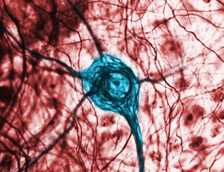Gαq signaling in primary sensory neurons shifts opioid analgesia to NMDA receptor–driven tolerance and hyperalgesia | Science Signaling