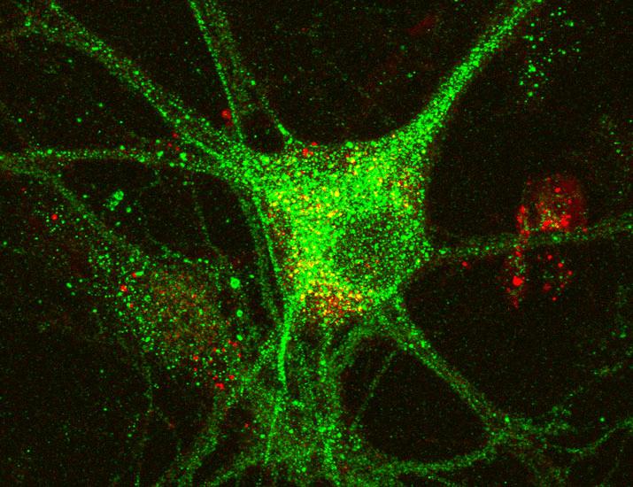 Stimulation of Ca2+ channel CaV1.2 activity by dopamine signaling augments spatial working memory | Science Signaling