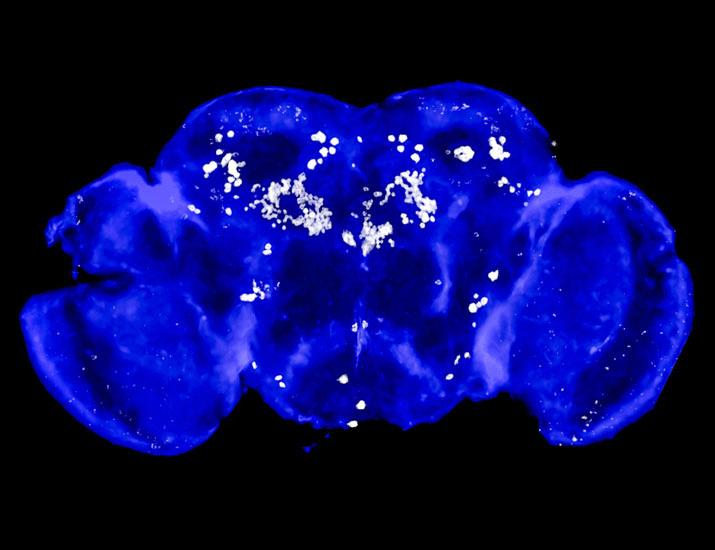 Fusobacterium nucleatum enhances amphetamine-induced behavioral responses through a butyrate-driven epigenetic mechanism | Science Signaling