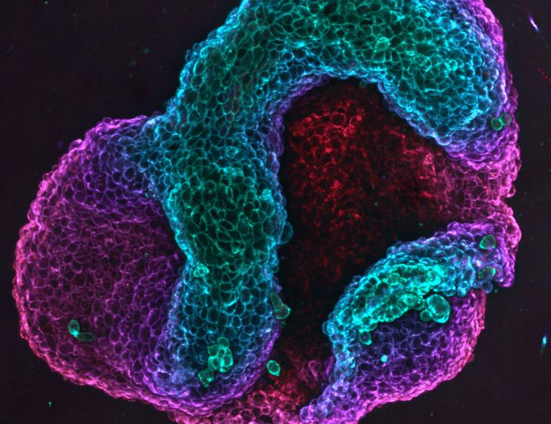 Topological Defects Shape Living Cell Sheets Into Predictable Structures - News Directory 3