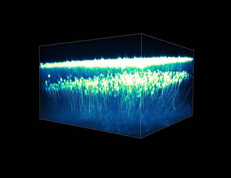 Artificial hibernation reveals synaptic engram architecture associated with memory retention | Science